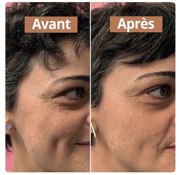 Sérum Anti-Âge Comme Avant