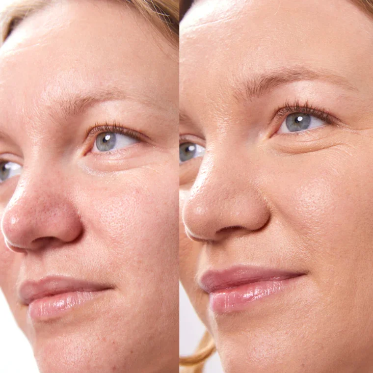 Concealer Balm 5 g
