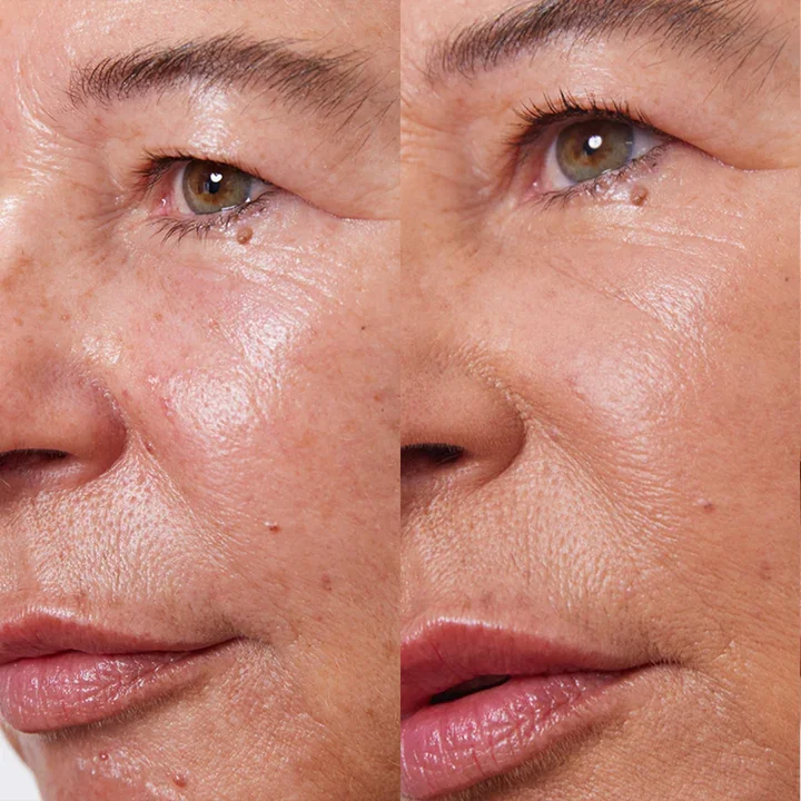 Concealer Balm 5 g