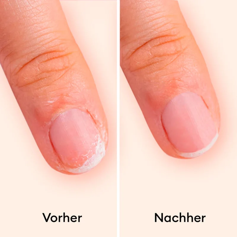 Kératine Booster 15 ml
