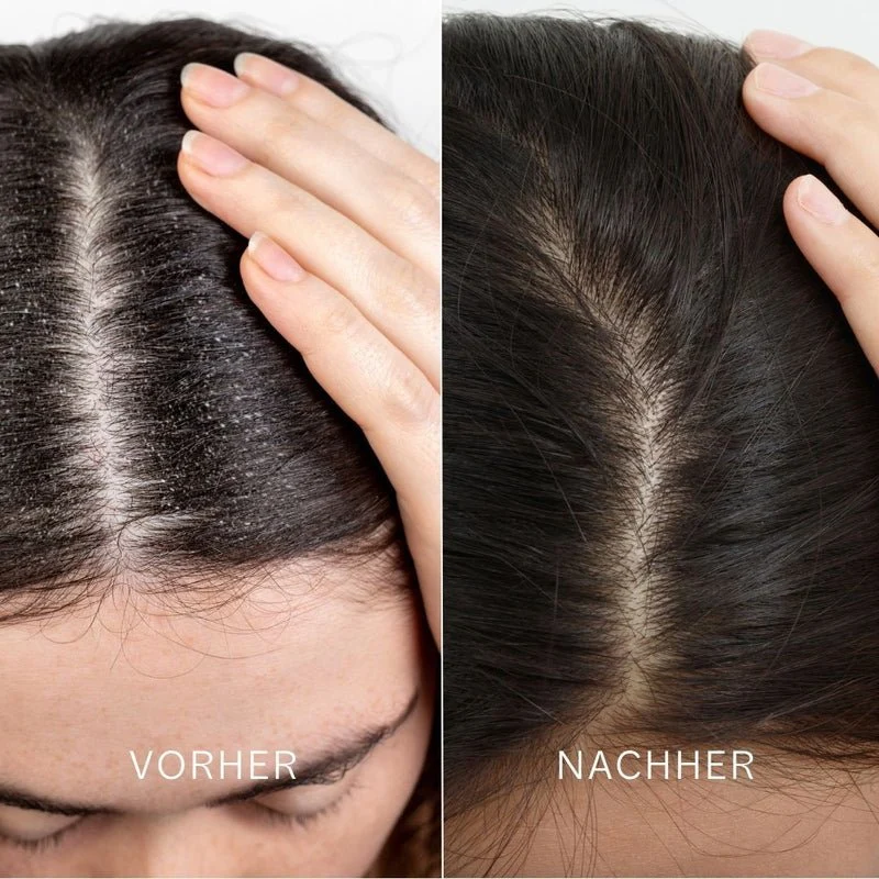 Scalp & Hair Detox Mask 100 ml