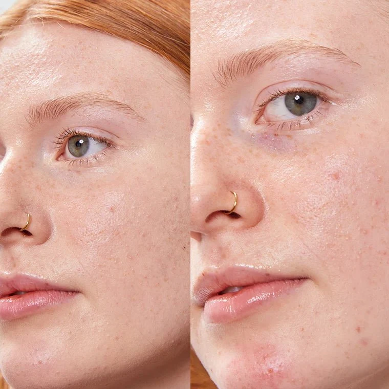 Concealer Balm 5 g (Vorherige Version)