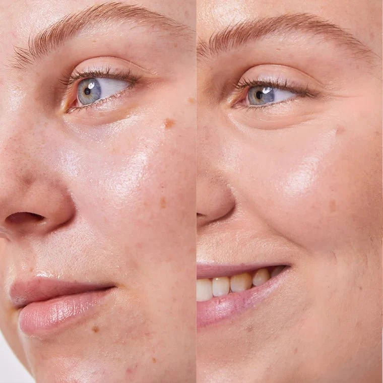 Concealer Balm 5 g (Vorherige Version)