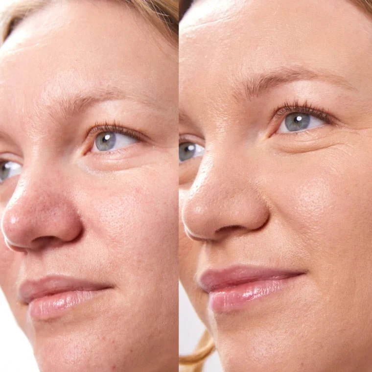 Concealer Balm 5 g (Vorherige Version)