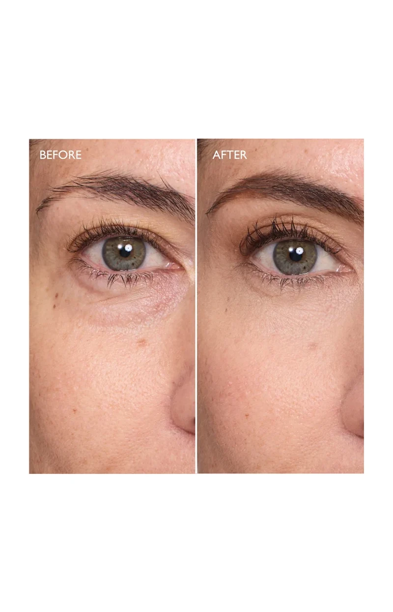 Soin contour des yeux miracle - Perfection Ultime™ - Niacinamide, vitamine E & aloe vera